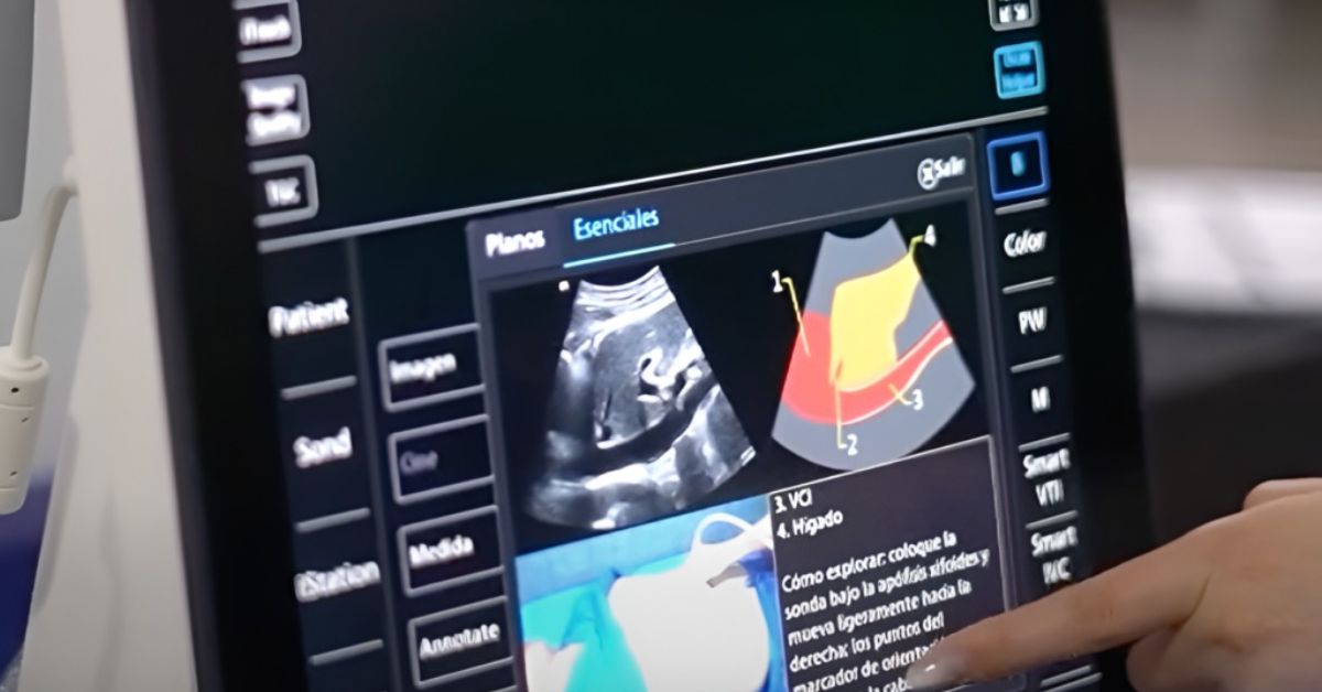 El Hospital Departamental San Vicente de Paúl adquirió equipos biomédicos de vanguardia